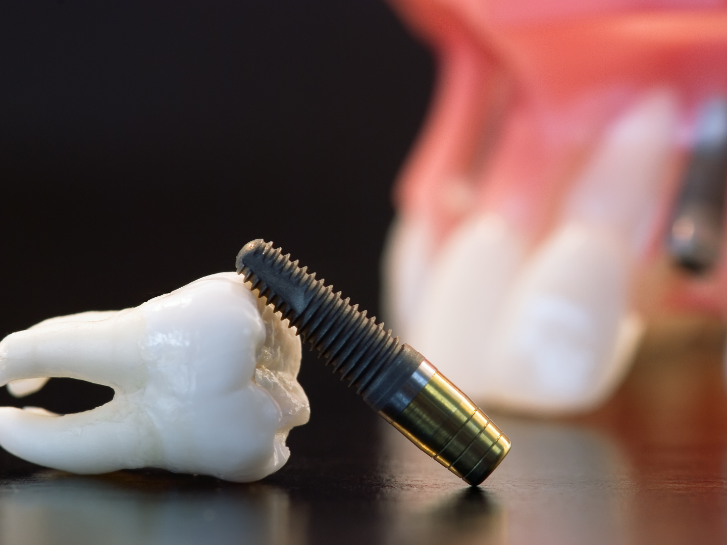 Newton, MA Dental Implants